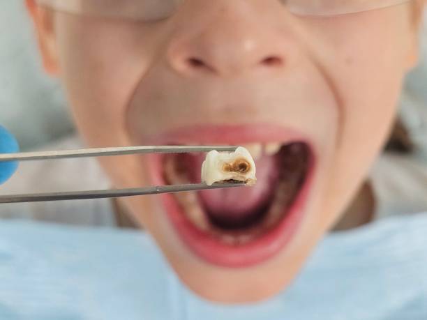 Best Pediatric Emergency Dentist in East Liverpool, OH